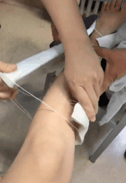 拆石膏后，发现左腿更细了爆笑gif搞笑图片