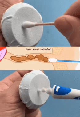 创意的掏耳朵神器图创意gif搞笑图片