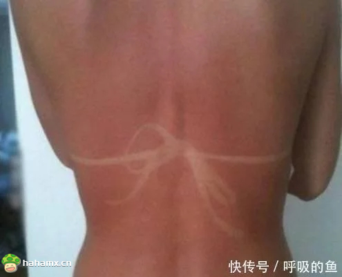 创意搞笑的晒伤印子图片创意gif搞笑图片