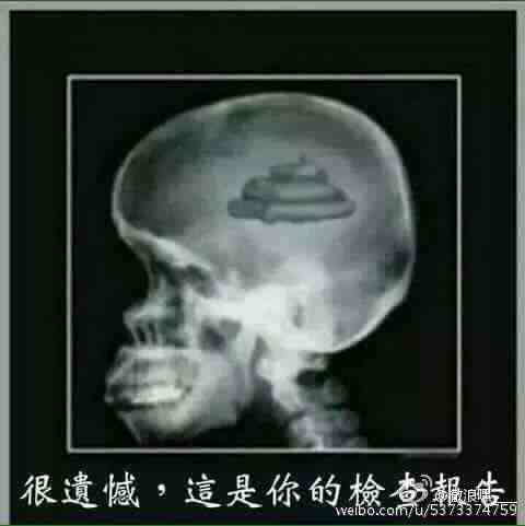 这是你脑袋的检查报告恶搞gif搞笑图片
