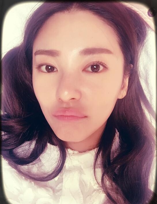 张雨绮的嘴肿么了明星gif搞笑图片