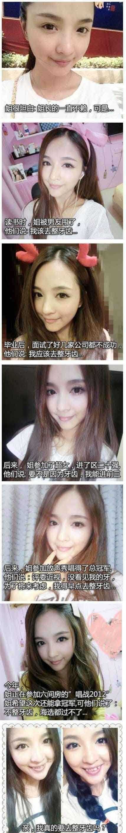 亲，我真的要去整牙齿吗？明星gif搞笑图片