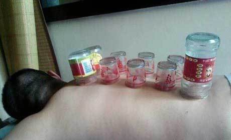 屌丝的新拨罐神器器物gif搞笑图片