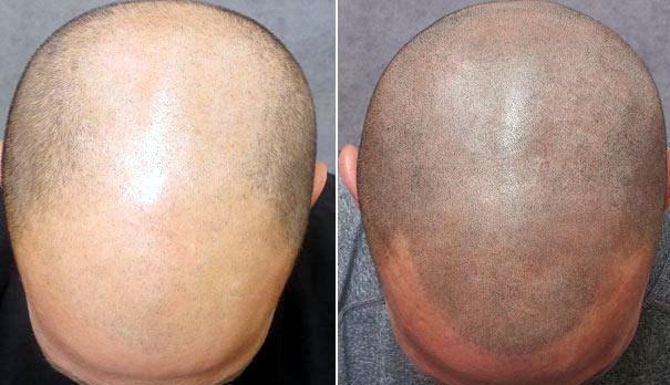 纹身师：治疗脱发我最在行了人物gif搞笑图片