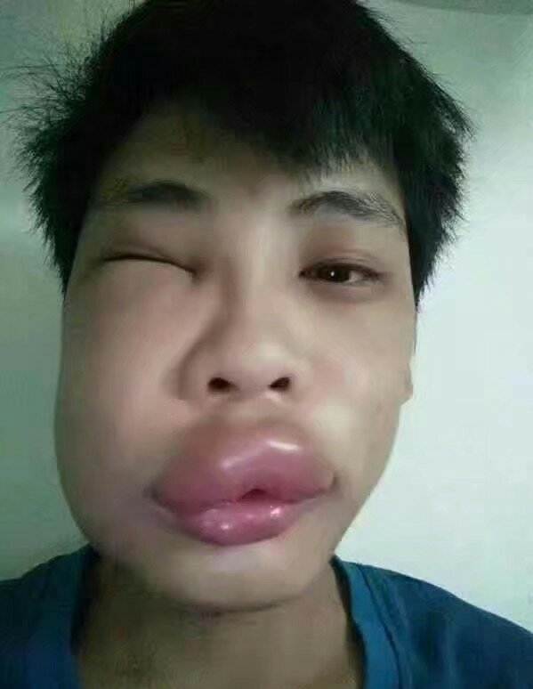 兄弟你肿么了，水嫩嫩的嘴唇好有魅力人物gif搞笑图片