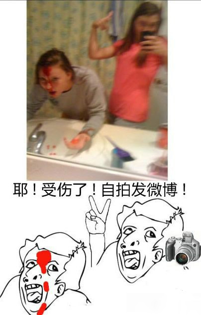 我受伤了，我要自拍发微博人物gif搞笑图片