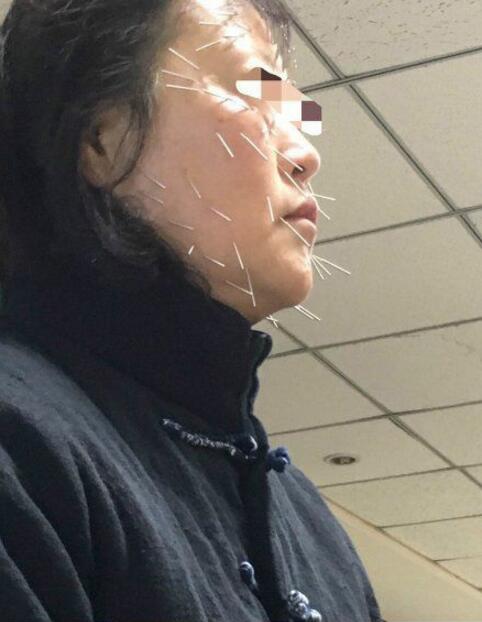 在医院看到的大姐，还以为她跟豪猪干了一架人物gif搞笑图片