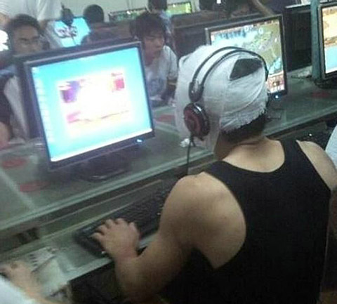 上网有助于伤口愈合人物gif搞笑图片