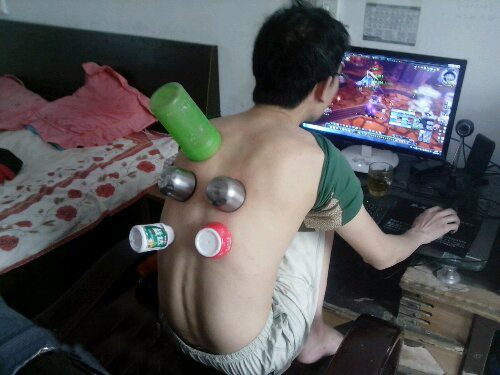 拔火罐的最高境界人物gif搞笑图片