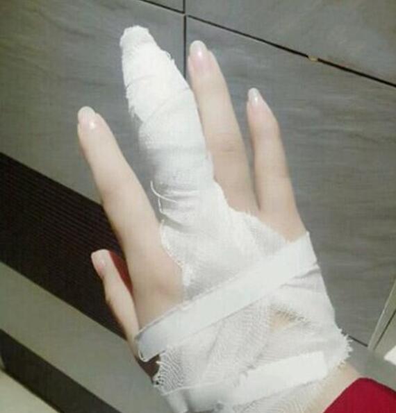 昨天闺蜜给我发了张照片，我问她怎么了也不告诉我，谁知道发生了什么？人物gif搞笑图片