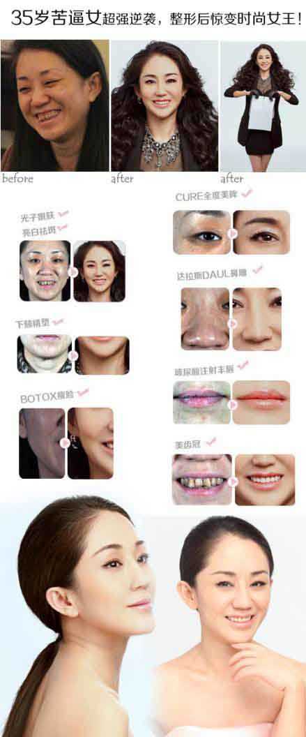 35岁苦女变时尚女王。。。给整形医生跪了人物gif搞笑图片