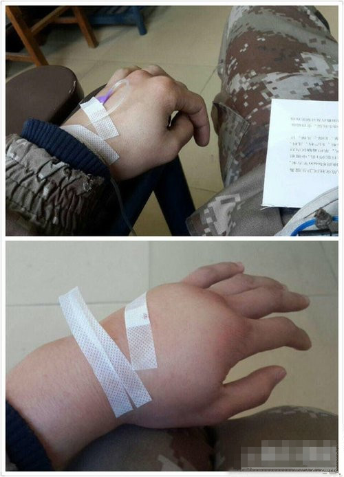 看到朋友打完点滴的手，我只想说护士 丧gan心de病piao狂liang啊！人物gif搞笑图片