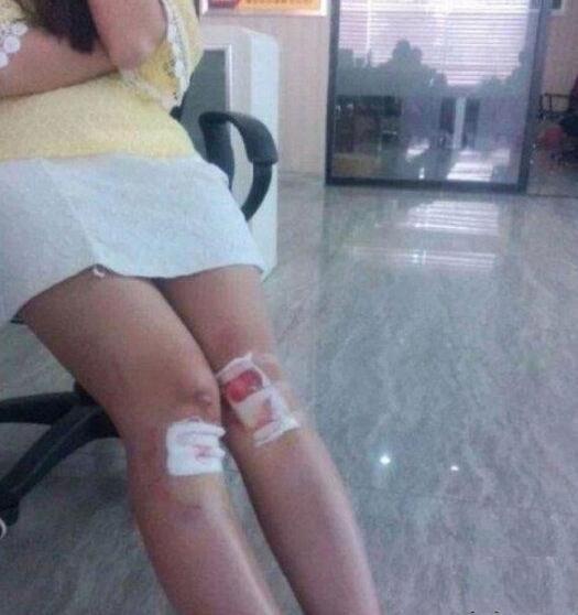 姑娘，你这伤的挺严重啊！人物gif搞笑图片