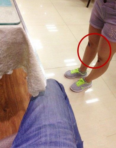 女朋友是不会保护自己，这不我昨天出差她就给摔伤了人物gif搞笑图片