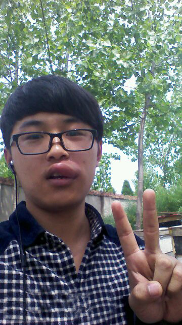 表弟的嘴唇被马蜂蛰了，让拍照留念下人物gif搞笑图片