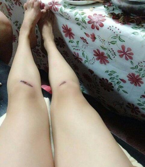 出差在外，老婆跟我说她受伤了，好心疼人物gif搞笑图片