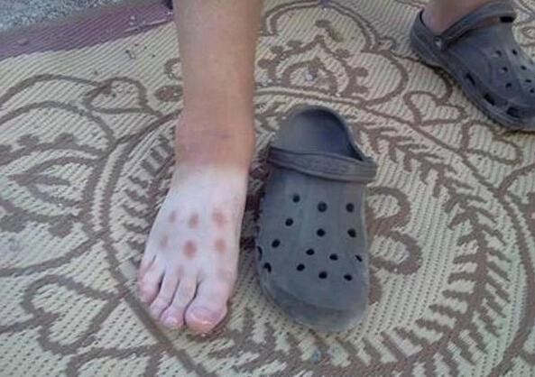 穿过洞洞鞋的都懂吧人物gif搞笑图片