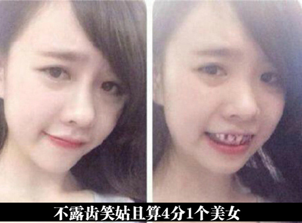 去整整牙齿吧人物gif搞笑图片