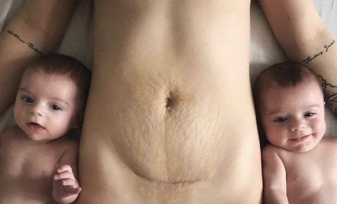 孕妇生过小孩的肚皮照社会gif搞笑图片