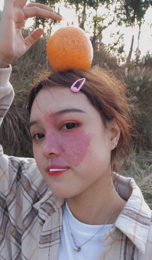 可爱脸部胎记的美女学生图社会gif搞笑图片