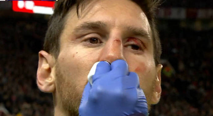 曼联0:1巴萨 梅西受伤图体育gif搞笑图片