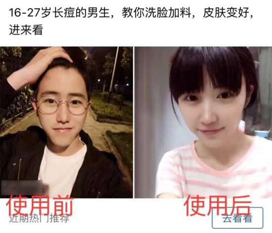 这是祛痘吗？这是整容变性啊综合gif搞笑图片