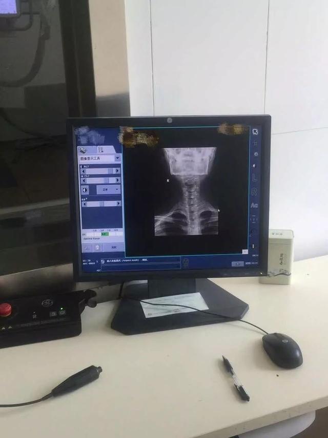 原来国字脸照X光是这样的啊哈哈综合gif搞笑图片