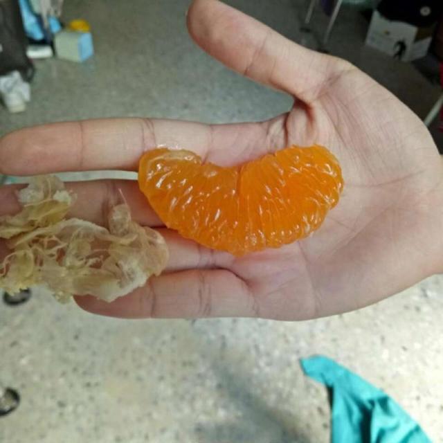 橘子：我做错了什么植物gif搞笑图片