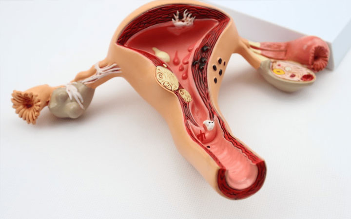 卵巢早衰能治好吗,分享卵巢早衰的食疗方法