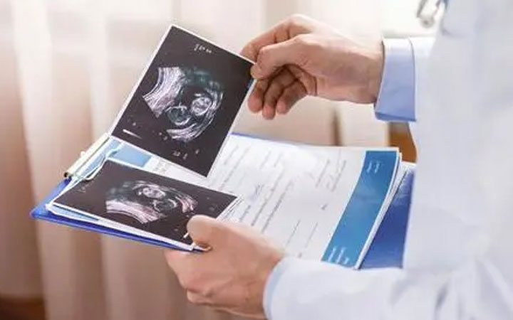 3个亮点可看性别准不准?是男是女彩超图真说不准