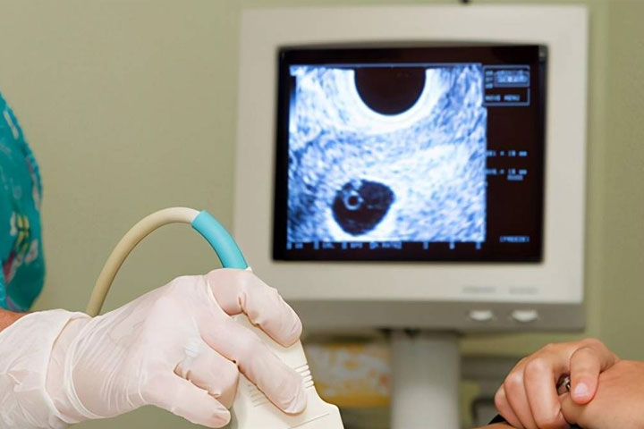 怀孕初期有褐色分泌物正常吗,分享怀孕初期出血的应对方法