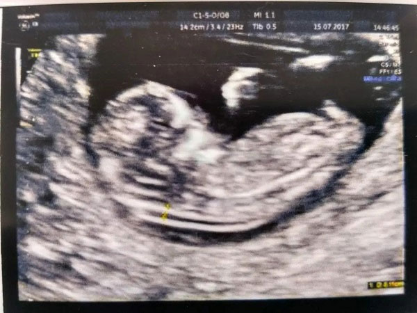 nt后面翘小尾巴的是否男孩？nt图上的小尾巴是什么