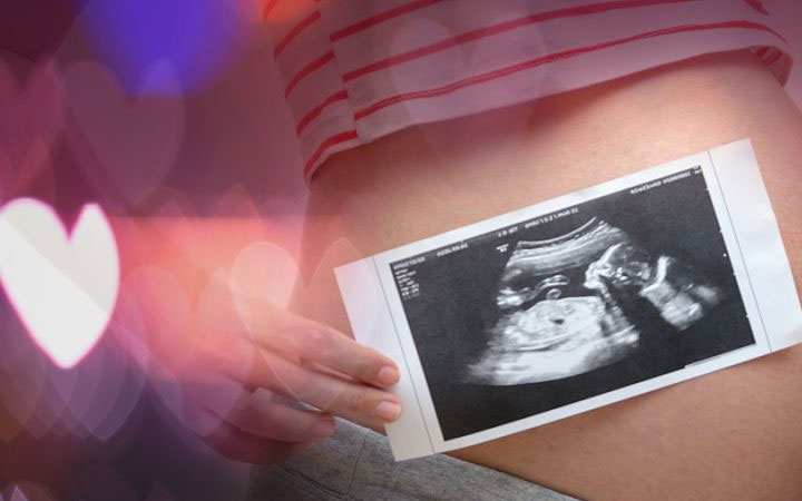 孕妇梦见狼为不吉之兆？周公解梦为你解读凶吉寓意