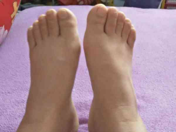孕晚期最后一个月脚肿看男女方法,脚腕水肿厉害是儿子