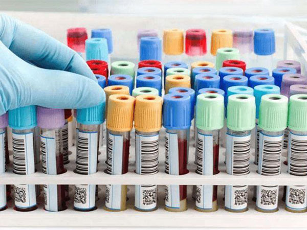 都说孕初期血值翻倍快慢决定男女，那男孩快还是女孩快？