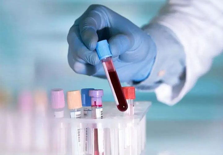 香港验血谨防上当受骗，三招教你轻松判断真伪