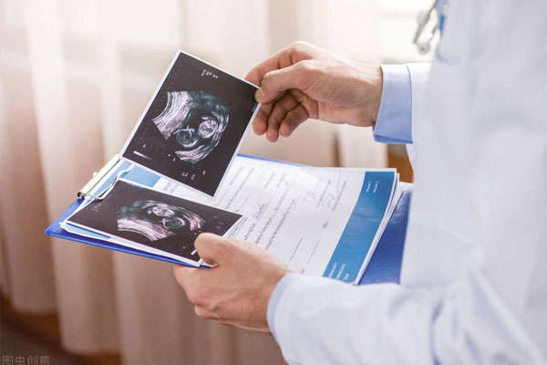 怀孕期间必查的项目，B超、血常规、NT等一览