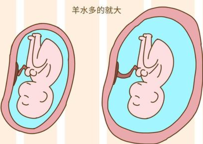 羊水对于妊娠期间是不可缺少的