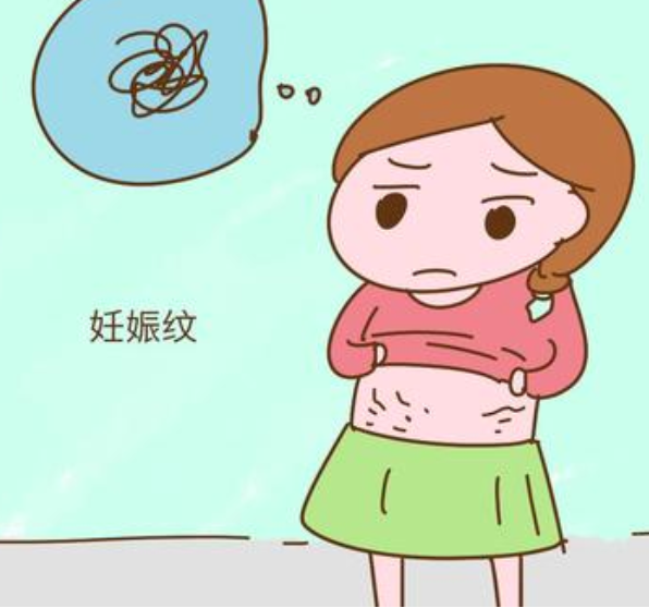 产后对于妊娠纹的防护以及解决方法