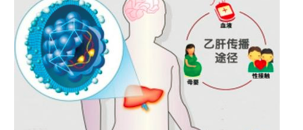 携带乙肝病毒的自己可以有正常的性生活吗