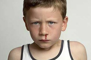 经常流鼻血是因为？