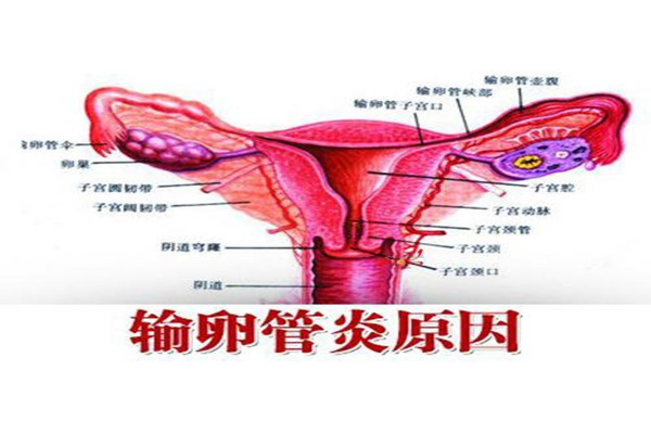 专家解析95%以上的宫外孕都与输卵管炎症有关