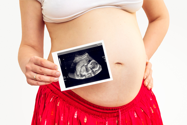 5种能看出怀男宝或女宝的诀窍 一怀孕就能看出！