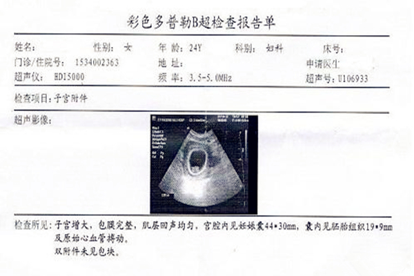 怀孕B超单图片详细解读，教你简单看懂B超单，一定要心中有数！