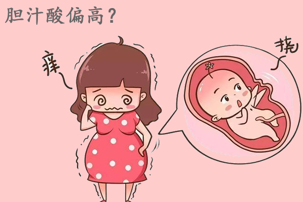孕妇总胆汁酸多高算严重？一旦超过这个值千万就要注意了