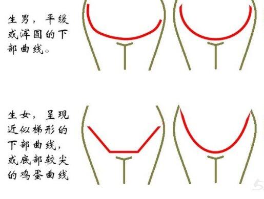 辟谣怀孕五个月看肚型辨男女是没有科学依据的