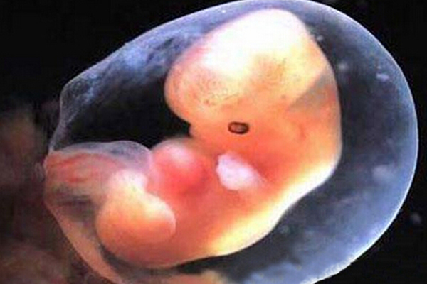 网传的“胎芽长短看男女”准吗？没有任何科学依据，大家别信