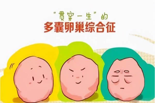 怎么判断是多囊，妇科专家教你1招用激素六项判断多囊