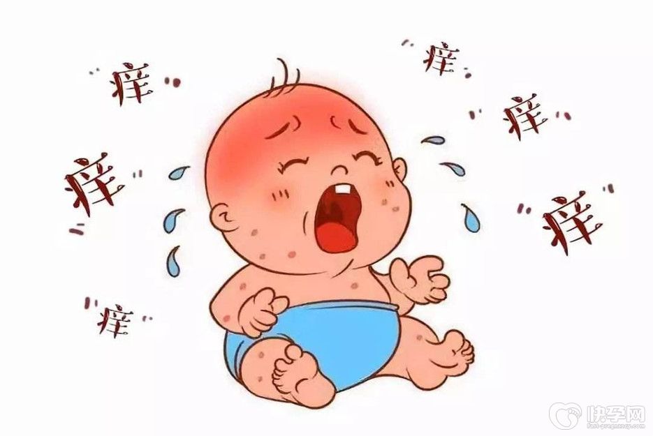 婴儿湿疹的4个最佳治疗方法，宝妈需知！