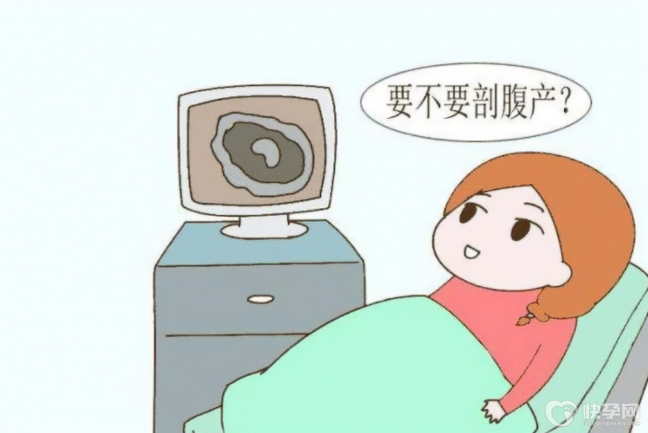 剖腹产分娩孩子的4个优缺点-了解后再选择分娩方式更稳妥